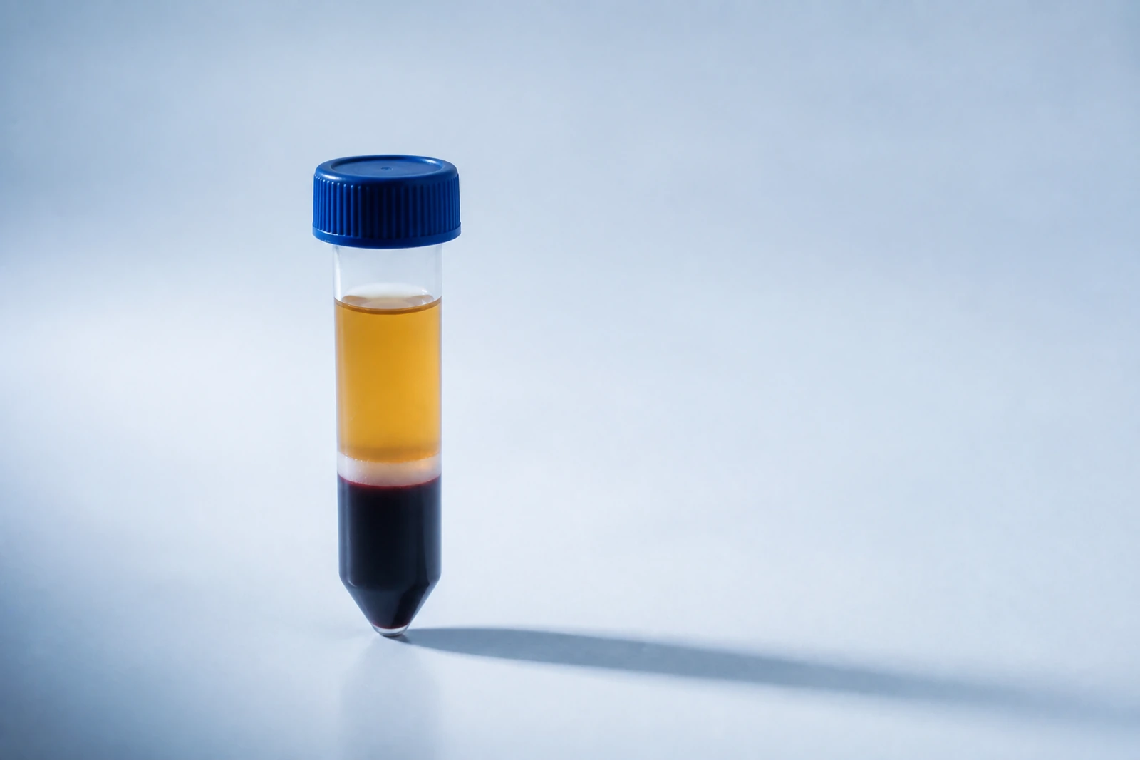 PRP for knee osteoarthritis