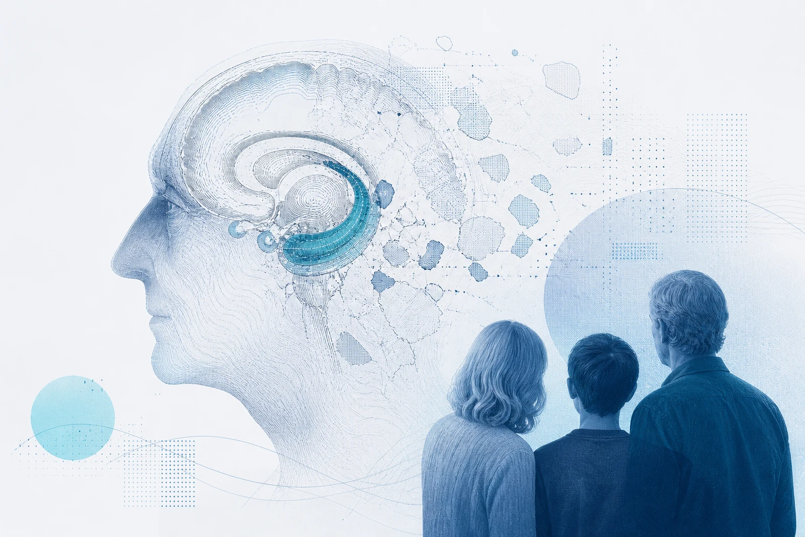 Alzheimer's disease evidence situation