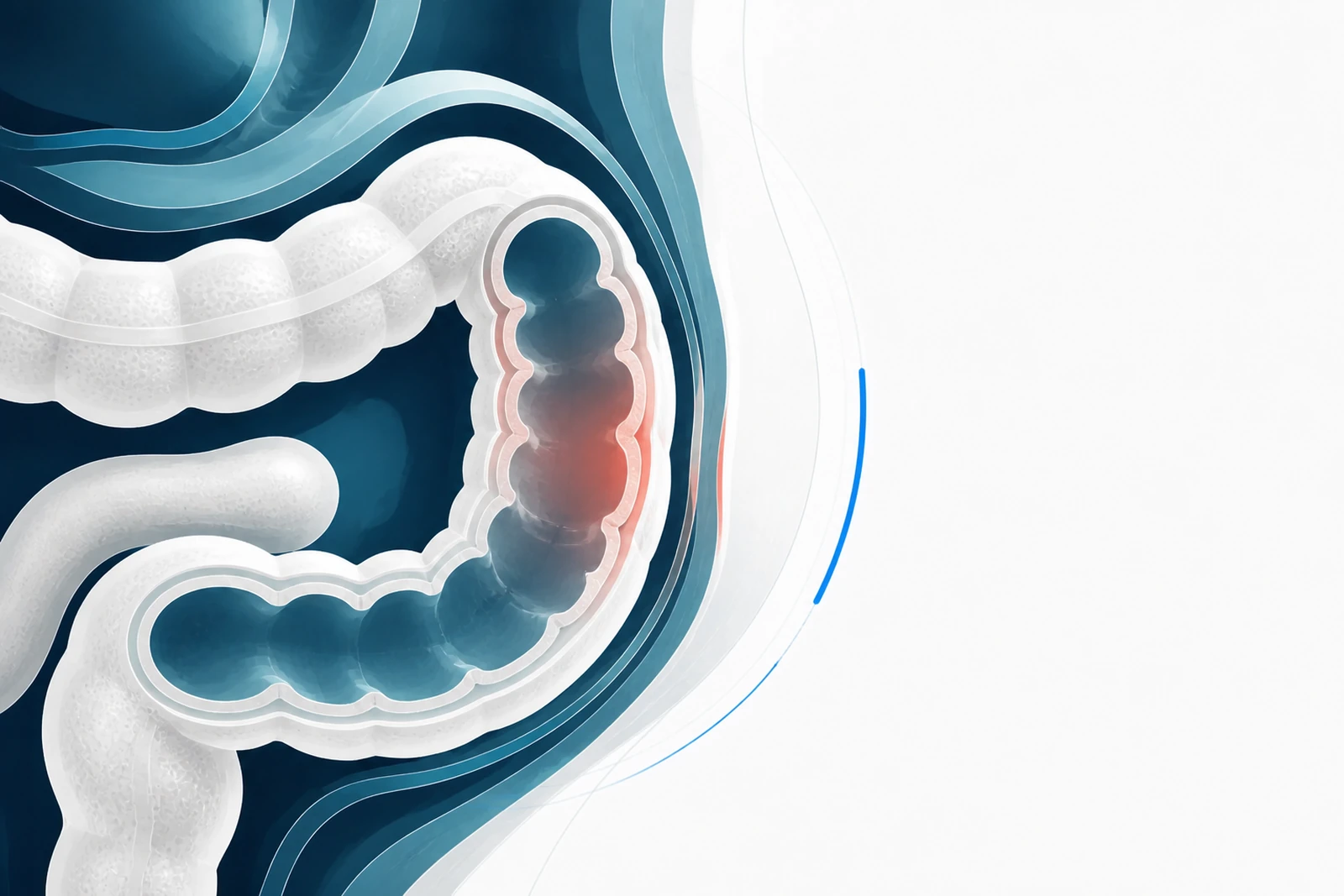 Crohn's disease evidence situation